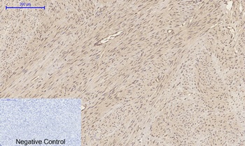 p300 antibody