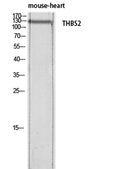 Thrombospondin 2 rabbit pAb