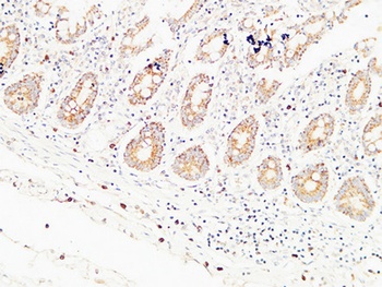 Thrombospondin 2 rabbit pAb