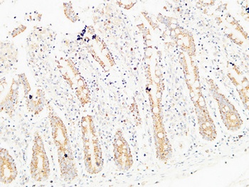 Thrombospondin 2 rabbit pAb