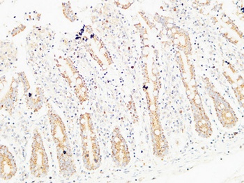 Thrombospondin 2 antibody