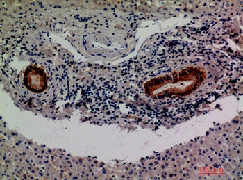 Factor XIII B antibody