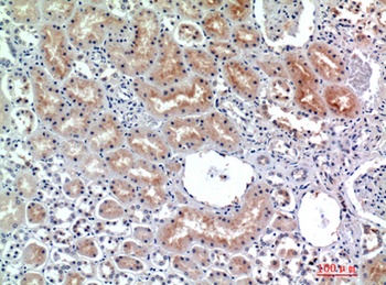 CD26 antibody