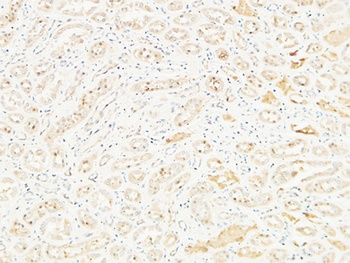 CD26 antibody
