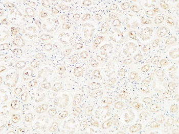 CD26 antibody