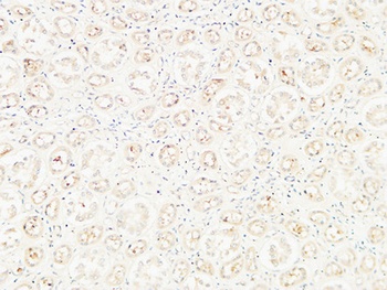 CD26 rabbit pAb