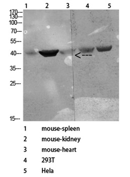 CD72 antibody