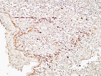 CD72 antibody