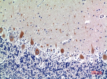 CD158e antibody