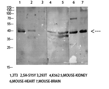 CD158e antibody