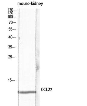 CTACK antibody