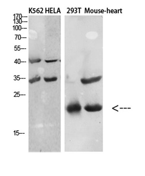 CTACK antibody