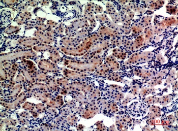 CD249 antibody