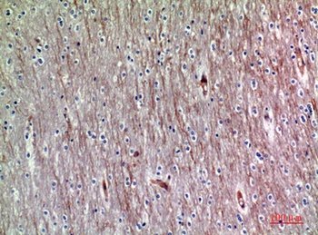 ADAMTS-18 antibody