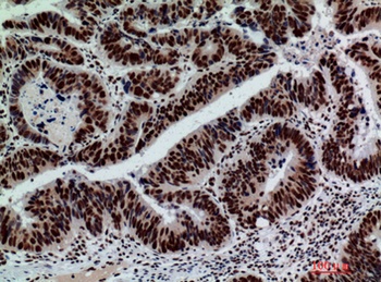 Galactosidase beta antibody