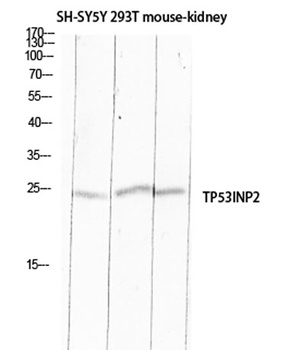 TP53INP2 rabbit pAb