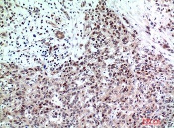 TP53INP2 rabbit pAb
