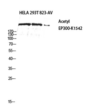 p300 (Acetyl Lys1542) rabbit pAb Antibody
