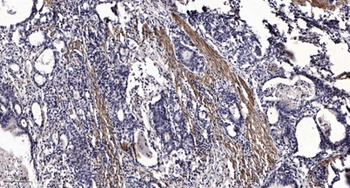 RIP140 (Acetyl Lys158) rabbit pAb