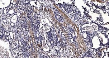 RIP140 (Acetyl Lys158) antibody