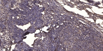 Stat3 (Acetyl Lys87) rabbit pAb Antibody