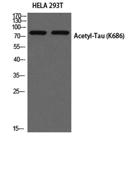 Tau (Acetyl Lys686) rabbit pAb Antibody