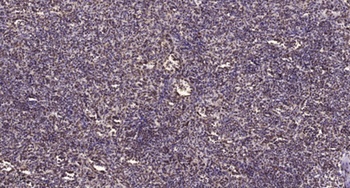 Atm (phospho Ser1981) rabbit pAb