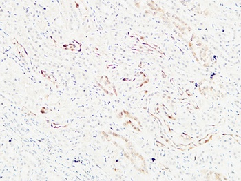 K-Ras antibody