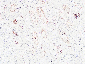 K-Ras antibody