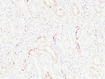 K-Ras antibody