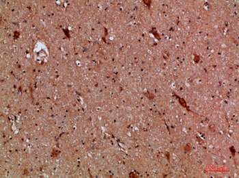 Calretinin rabbit pAb