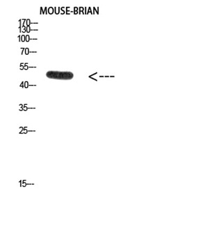 E2F-1 (Acetyl Lys120) rabbit pAb