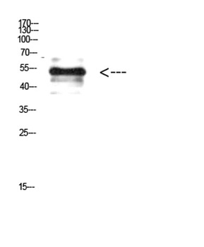 Vimentin (Phospho-Tyr38) rabbit pAb