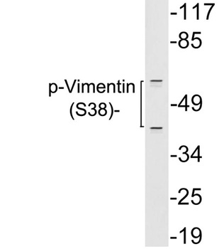 Vimentin (Phospho-Tyr38) antibody