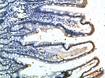 E-selectin antibody