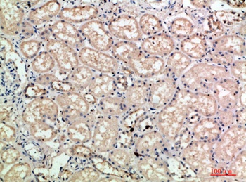 E-selectin antibody