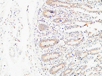 E-selectin antibody