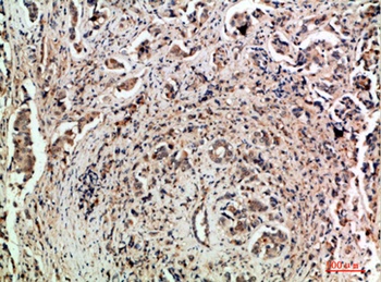 TLE1/2/3/4 antibody