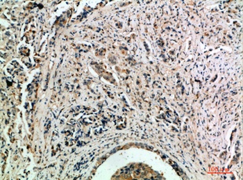 TLE1/2/3/4 antibody