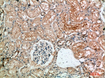 TLE1/2/3/4 antibody