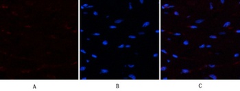 PTEN antibody