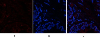 PTEN antibody