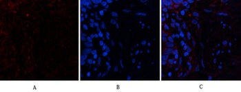 PTEN antibody