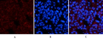 Amyloid-β rabbit pAb