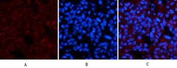 Amyloid-beta antibody