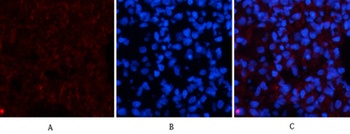 Amyloid-beta antibody