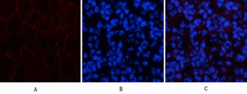 Amyloid-beta antibody