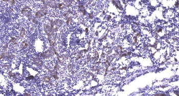 PI 3 Kinase Class 3 rabbit pAb