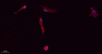 Collagen I rabbit pAb