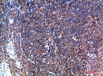Tryptase-3 rabbit pAb